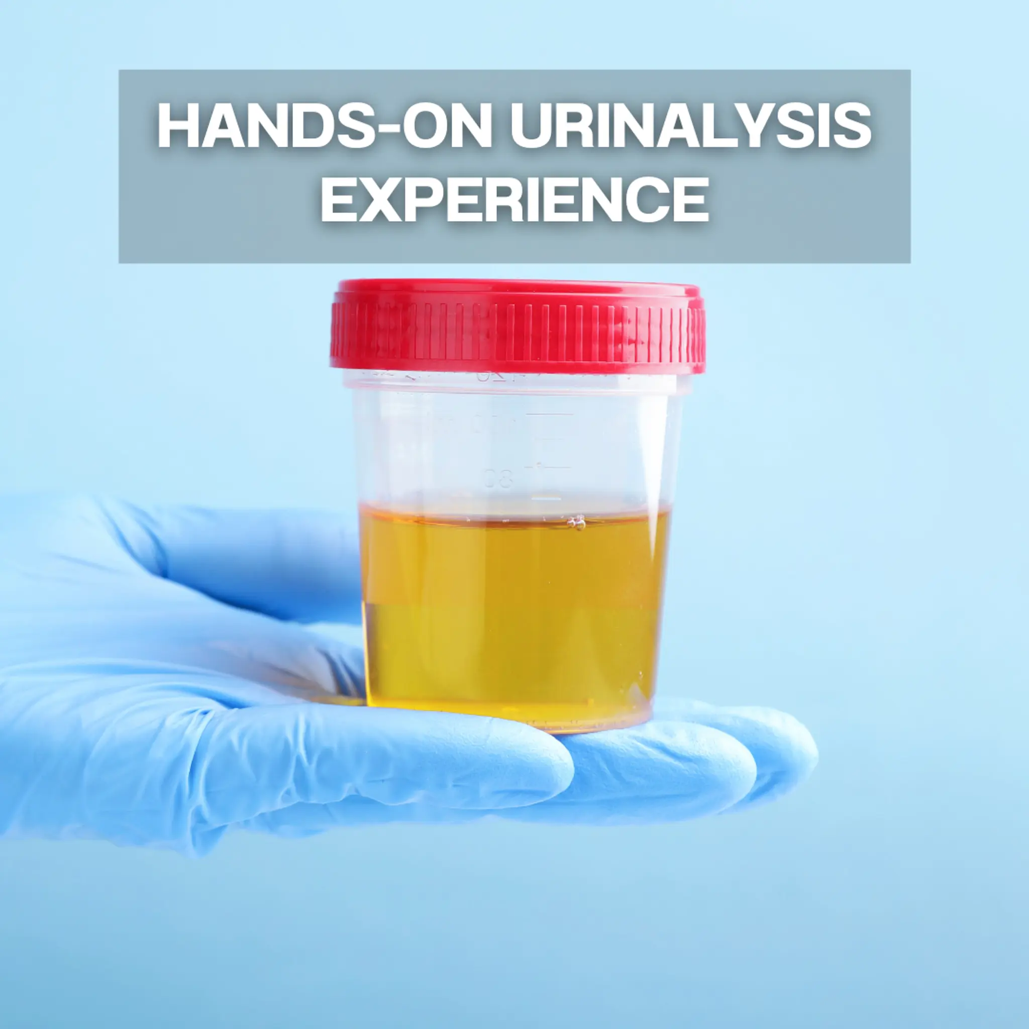 Hands-on urinalysis experience (ประสบการณ์ตรวจปัสสาวะแบบลงมือปฏิบัติจริง)