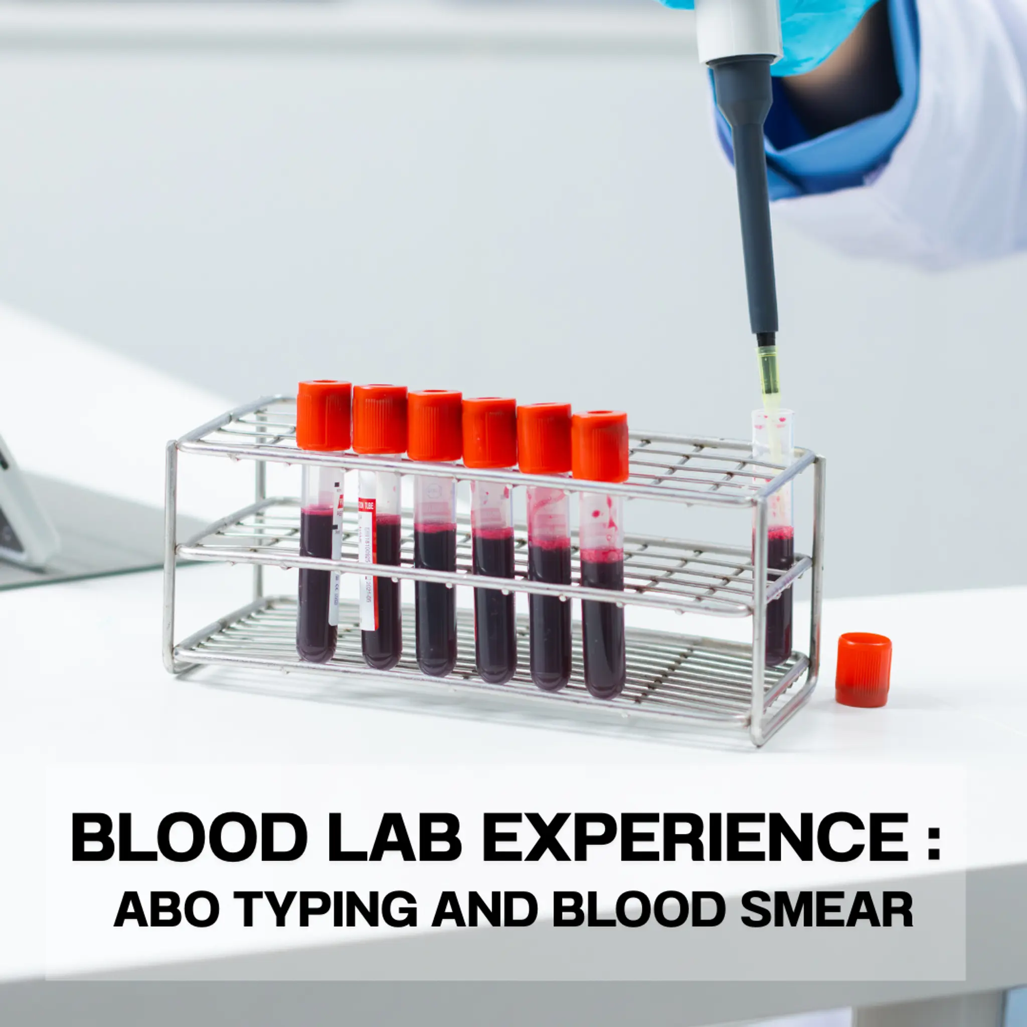 Blood lab experience: ABO typing and blood smear (เปิดประสบการณ์แล็บเลือด: ตรวจกรุ๊ปเลือด ABO และดูสไลด์เลือด)